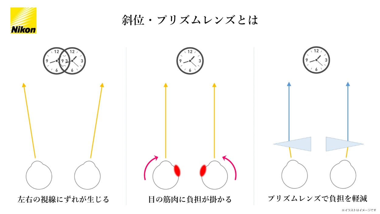 斜位プリズムレンズとは　プリズムレンズで負担を軽減